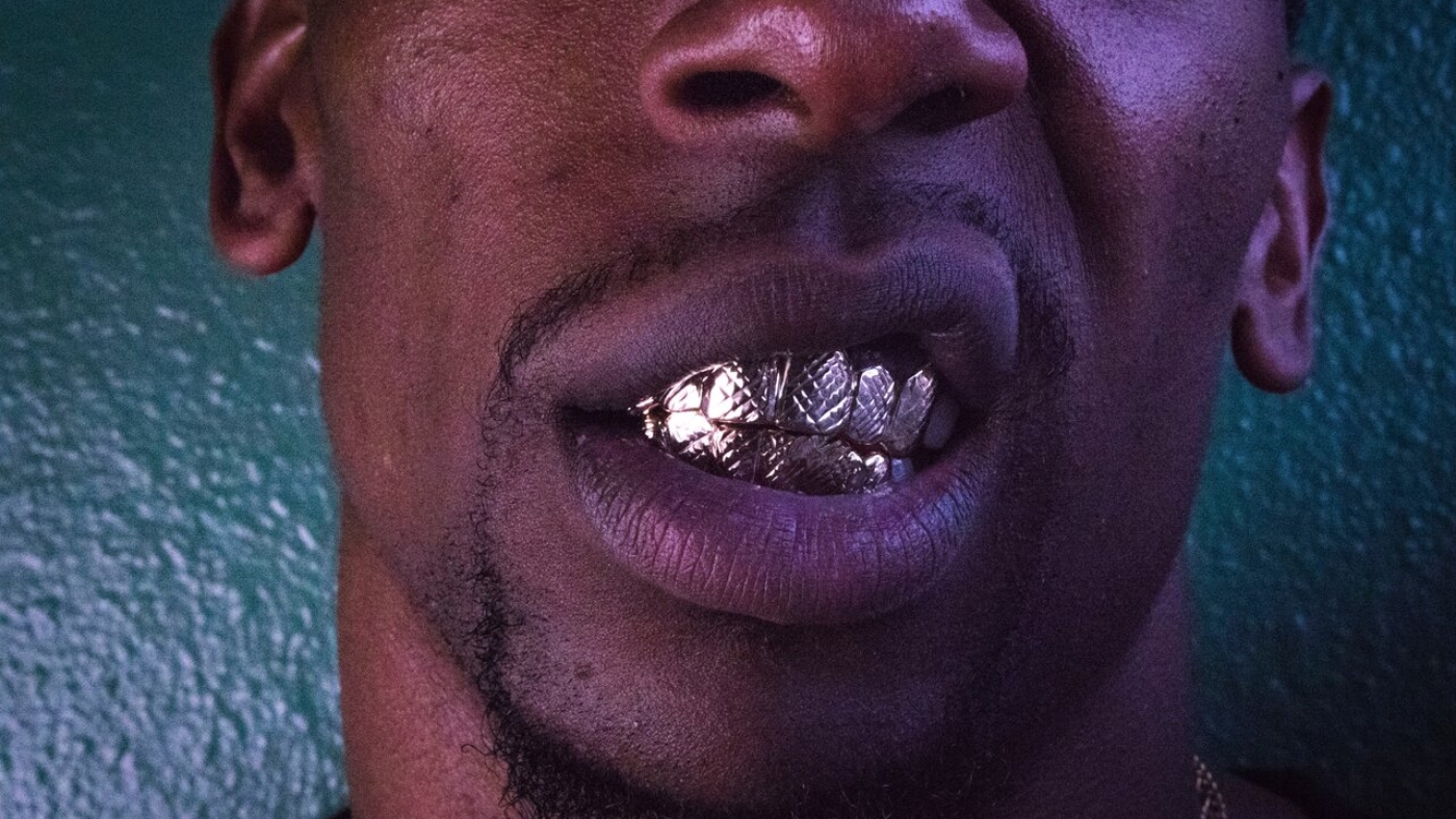 titelbild-zahngold-dentalgold-zu-geld-machen