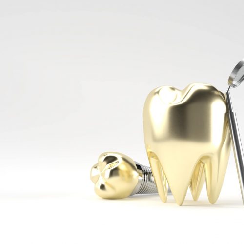 zahngold-ankauf-zahn-gold